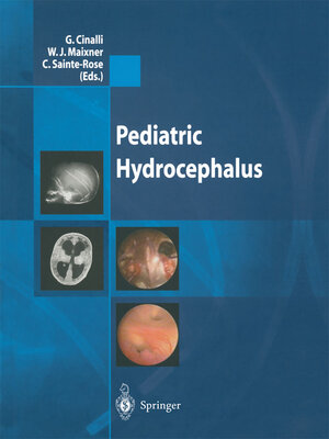 cover image of Pediatric Hydrocephalus